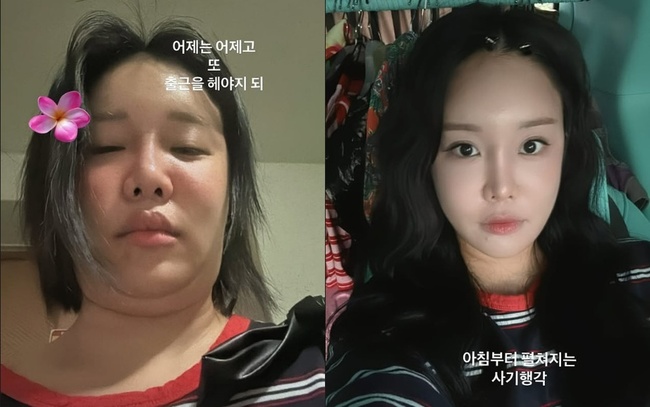 랄랄 소셜미디어